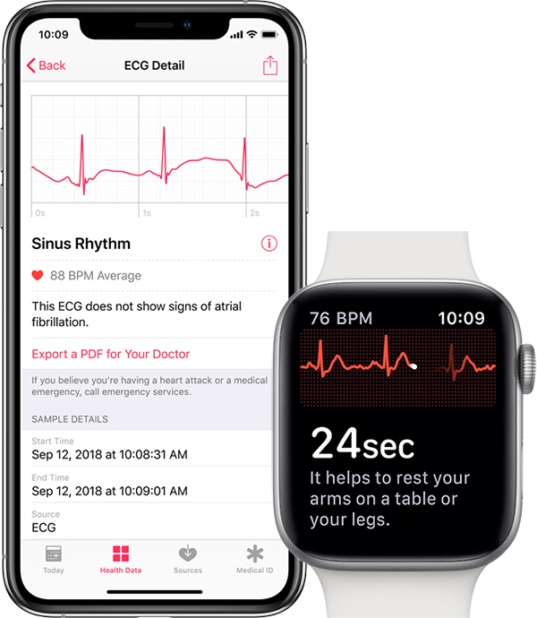 watchOS 5.1.2 coming today 3 iphone apple watch ecg