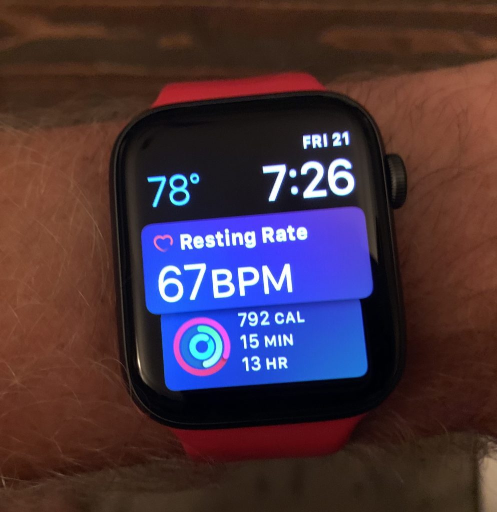 Apple Watch Series 4 Review: The Big Time 4 39ru9rjtTjaPx0GBOuNwvA e1537879598723
