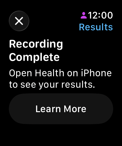 Why I Bought an Apple Watch Series 10 in 2025 (Even After Series 11 Launched) 5 Screenshot of a blog post titled "Blood Oxygen Shenanigans" with two images of an Apple Watch screen. The left image shows a black screen with the text "Recording Complete" and "Open Health on iPhone to see your results," along with a "Learn More" button. The right image displays a colorful abstract pattern with the time "11:59" and a small icon of a person.
